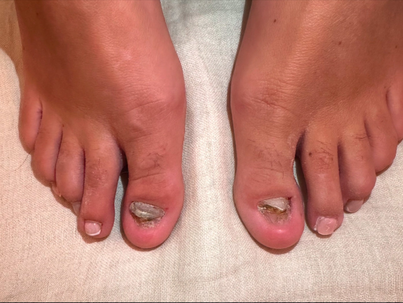 The Toe Nail Reconstruction Ritual - Tuesday 19th May 2026